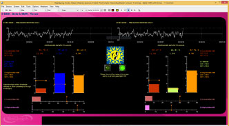 EEG Suite Beta and SMR training screen